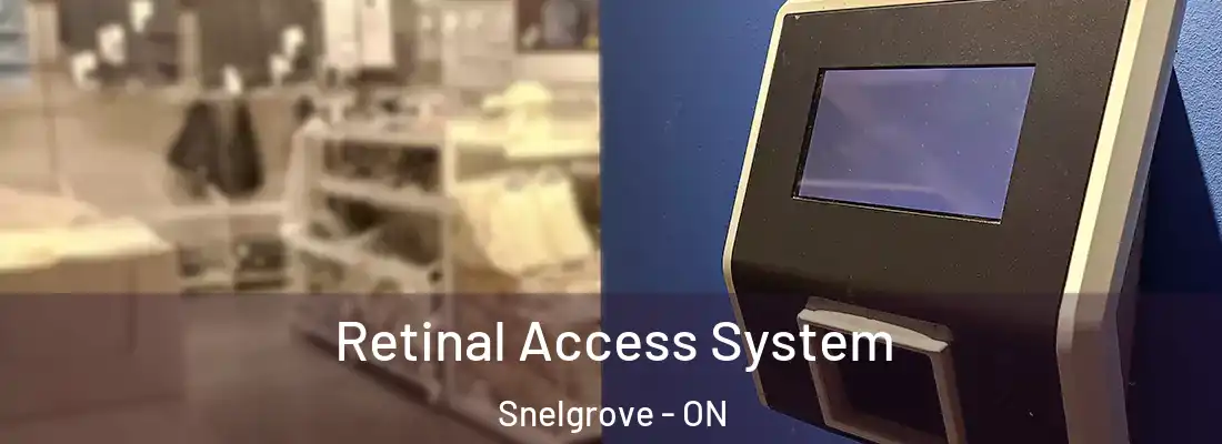  Retinal Access System Snelgrove - ON
